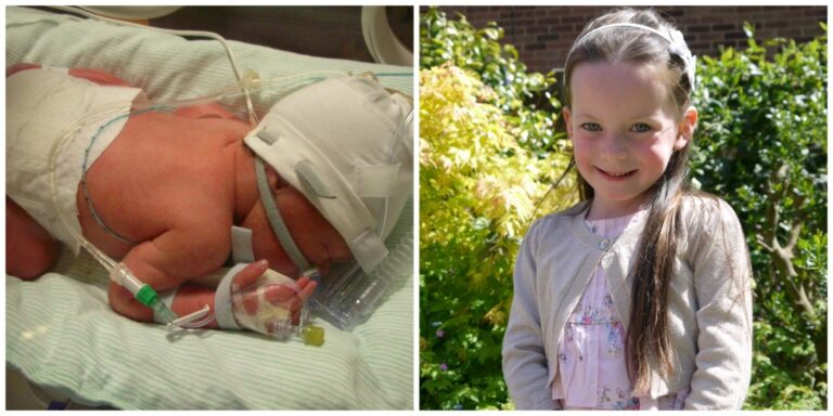 A side-by-side photo: on the left, a newborn baby in a nappy with medical tubes and monitors; on the right, a smiling young girl outdoors in a dress—celebrating how far our Birthday Girlies have come. Happy Birthday!.