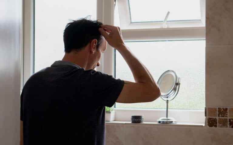 A man stands in a bathroom facing a frosted window, scratching his head—perhaps contemplating a hair transplant. A round mirror, small container, and plant rest on the softly lit windowsill.